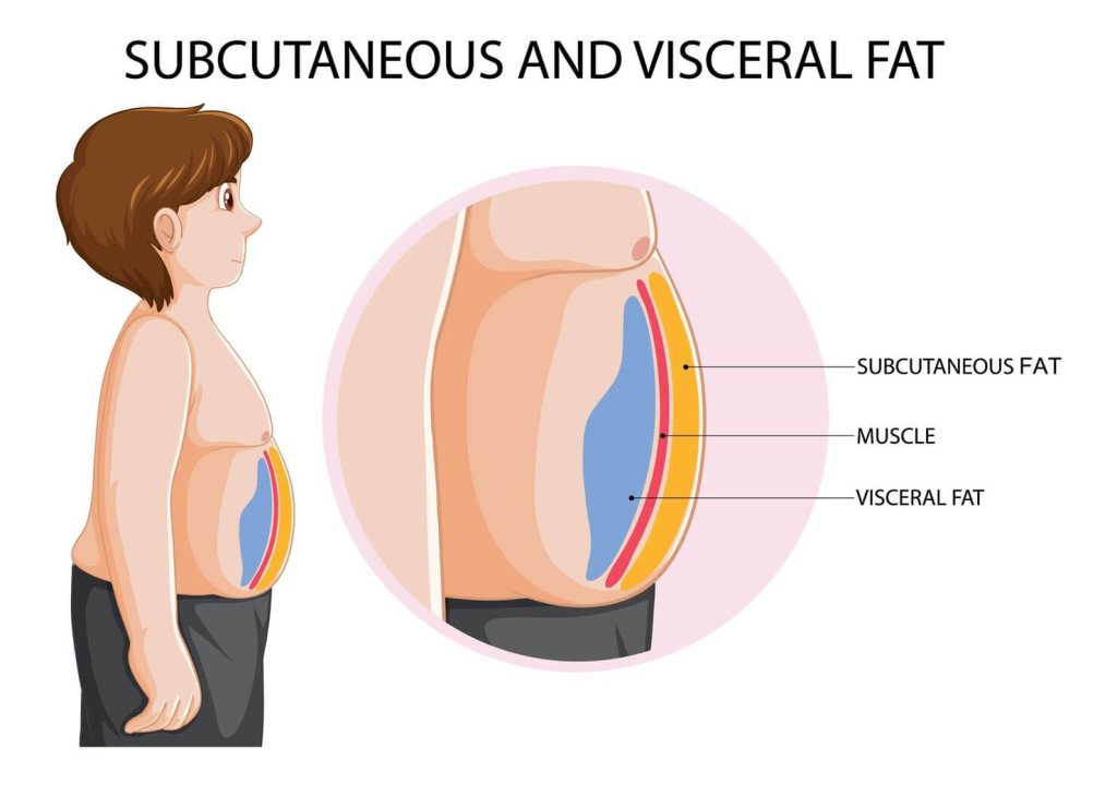 ​what is visceral fat​