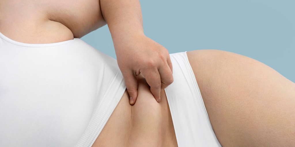 body contouring love handles