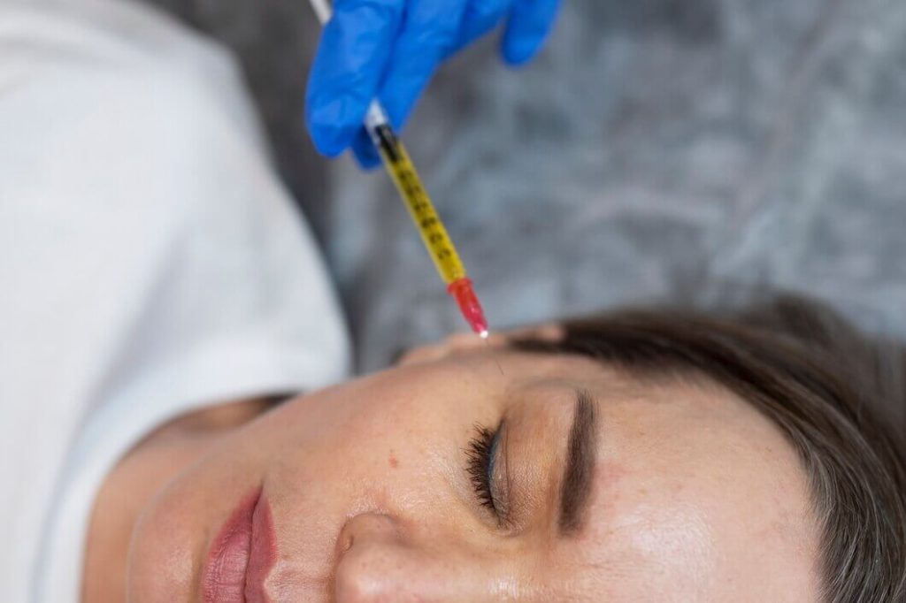 ​mesotherapy vs prp​