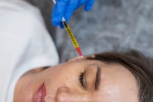 ​mesotherapy vs prp​