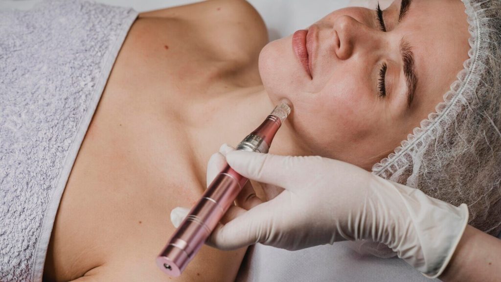 ​mesotherapy vs. microneedling